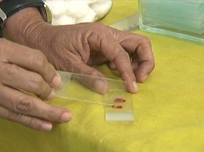 No Par&aacute;, casos de mal&aacute;ria reduzem 66% de janeiro a agosto de 2014