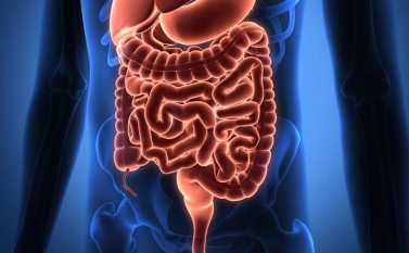 Especialista afirma que crescem os casos de Doenças Inflamatórias do Intestino em Parauapebas