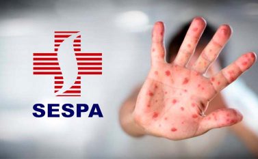 Sespa emite alerta aos municípios sobre surto de sarampo em navio de cruzeiro