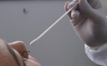 Com medo da Covid, Canaã dos Carajás vai comprar mais 6 mil testes PCR